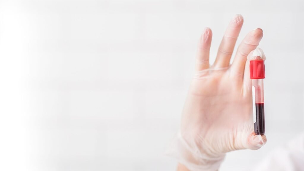 AR TURĖTI AUKŠTĄ MTL-Ch VISADA YRA BLOGAI?