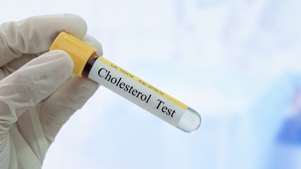 NUMEČIAU 10KG O CHOLESTEROLIS PAKILO – KODĖL?