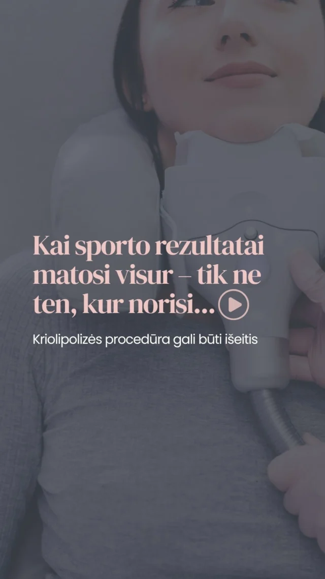 Kriolipolizė – nechirurginė kūno kontūravimo procedūra, skirta mažinti lokalizuotas riebalų sankaupas tose vietose, kurios dažnai nereaguoja į sportą ar mitybos pokyčius. Procedūros metu riebalinės ląstelės veikiamos kontroliuojamu šalčiu, todėl jos palaipsniui suyra, o organizmas jas natūraliai pašalina.

Registruokis nemokamai konsultacijai ir rask geriausią sprendimą.

Registracija:�📞 +370 686 11 311�✉️ info@idclinic.lt